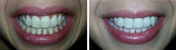 Tratamientos Servicios Dr Eduardo Estupiñan Odontologo Ibague
