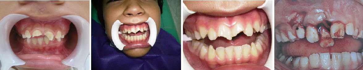 Tratamientos Servicios Dr Eduardo Estupiñan Odontologo Ibague