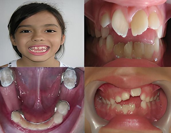 Tratamientos Servicios Dr Eduardo Estupiñan Odontologo Ibague