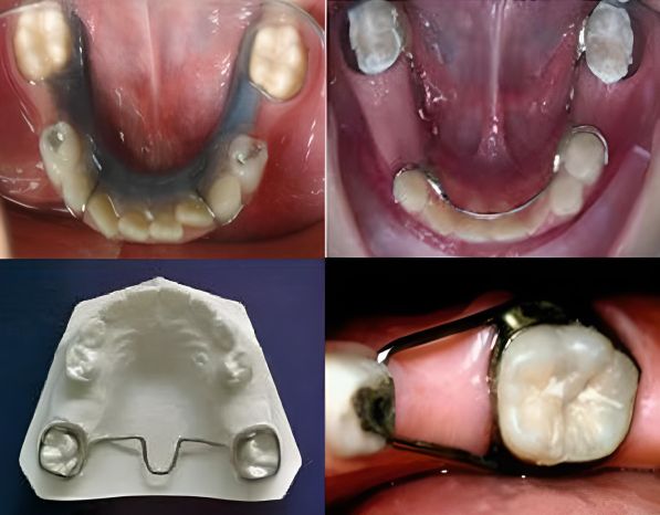Tratamientos Servicios Dr Eduardo Estupiñan Odontologo Ibague